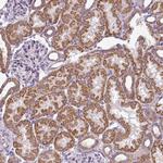 GAN Antibody in Immunohistochemistry (Paraffin) (IHC (P))