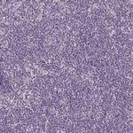 GAN Antibody in Immunohistochemistry (Paraffin) (IHC (P))