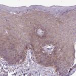 GAN Antibody in Immunohistochemistry (Paraffin) (IHC (P))