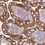 GAN Antibody in Immunohistochemistry (Paraffin) (IHC (P))