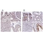 hnRNP UL1 Antibody in Immunohistochemistry (IHC)