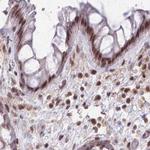 hnRNP UL1 Antibody in Immunohistochemistry (IHC)