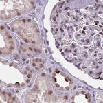 hnRNP UL1 Antibody in Immunohistochemistry (IHC)