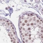 hnRNP UL1 Antibody in Immunohistochemistry (IHC)