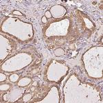 RSBN1 Antibody in Immunohistochemistry (Paraffin) (IHC (P))