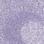 Podocin Polyclonal Antibody