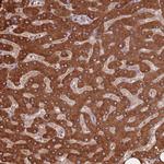 COQ5 Polyclonal Antibody