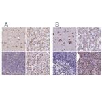 CASC4 Antibody in Immunohistochemistry (IHC)