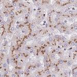 CASC4 Antibody in Immunohistochemistry (IHC)