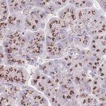 CASC4 Antibody in Immunohistochemistry (IHC)