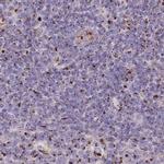CASC4 Antibody in Immunohistochemistry (IHC)