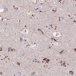 CASC4 Antibody in Immunohistochemistry (IHC)