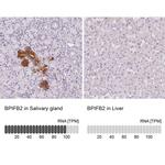 BPIL1 Antibody in Immunohistochemistry (IHC)