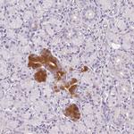 BPIL1 Antibody in Immunohistochemistry (IHC)