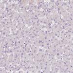 BPIL1 Antibody in Immunohistochemistry (IHC)