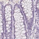 BPIL1 Antibody in Immunohistochemistry (IHC)
