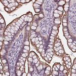 C19orf21 Antibody in Immunohistochemistry (Paraffin) (IHC (P))