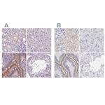 C19orf21 Antibody in Immunohistochemistry (IHC)