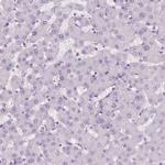 C19orf21 Antibody in Immunohistochemistry (IHC)