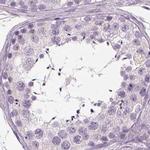 C19orf21 Antibody in Immunohistochemistry (IHC)