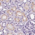 C19orf21 Antibody in Immunohistochemistry (IHC)