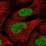 PCIF1 Antibody in Immunocytochemistry (ICC/IF)