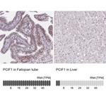 PCIF1 Antibody in Immunohistochemistry (IHC)