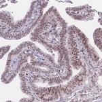PCIF1 Antibody in Immunohistochemistry (IHC)