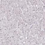 PCIF1 Antibody in Immunohistochemistry (IHC)