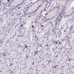 BHMG1 Polyclonal Antibody