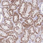 INTS2 Polyclonal Antibody