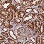 MTRES1 Antibody in Immunohistochemistry (Paraffin) (IHC (P))