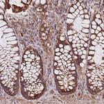 MTRES1 Antibody in Immunohistochemistry (Paraffin) (IHC (P))