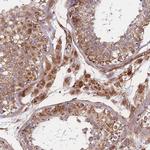 MTRES1 Antibody in Immunohistochemistry (Paraffin) (IHC (P))