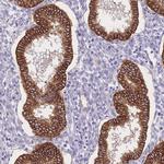 C2orf88 Antibody in Immunohistochemistry (Paraffin) (IHC (P))