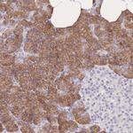 C2orf88 Antibody in Immunohistochemistry (Paraffin) (IHC (P))