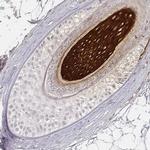 Cytokeratin 31 Polyclonal Antibody