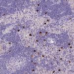 TPSD1 Polyclonal Antibody