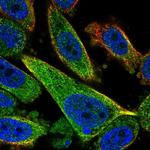 TCTEX1D2 Polyclonal Antibody