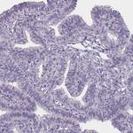 SLC35E4 Antibody in Immunohistochemistry (Paraffin) (IHC (P))