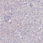 SLC35E4 Antibody in Immunohistochemistry (Paraffin) (IHC (P))