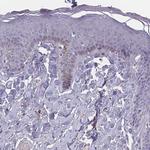 SLC35E4 Antibody in Immunohistochemistry (Paraffin) (IHC (P))