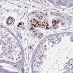 SLC35E4 Antibody in Immunohistochemistry (Paraffin) (IHC (P))