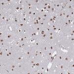 PLEKHG5 Antibody in Immunohistochemistry (Paraffin) (IHC (P))