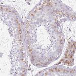 ANKRD53 Polyclonal Antibody