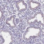 OR5A2 Polyclonal Antibody