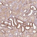 PALM Polyclonal Antibody
