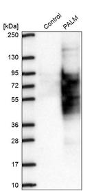 PALM Antibody in Western Blot (WB)