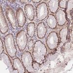 PUS10 Antibody in Immunohistochemistry (Paraffin) (IHC (P))