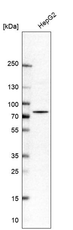 PUS10 Antibody in Western Blot (WB)